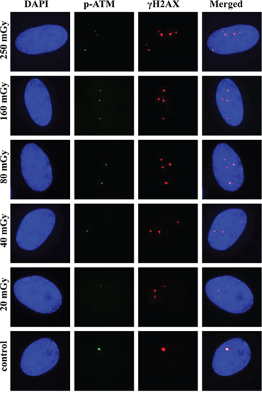 Representative images of &#x03B3;H2AX and pATM foci and their co-localization at 240 min post-irradiation.