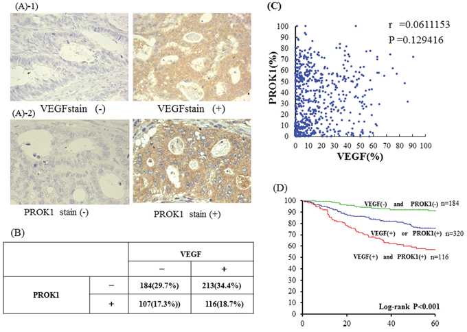 A-1. Immunohistochemical staining with anti-VEGF mAb Left: VEGF expression was not detected inprimary colorectal cancer lesion.