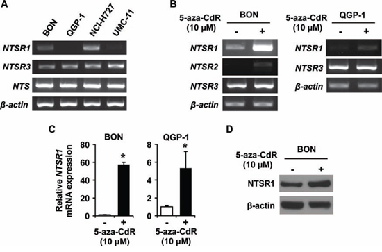 Expression analysis of NTSRs in endogenous and 5-aza-CdR treated NET cell lines.