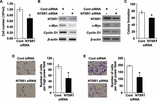 Knockdown of NTSR1 affects NET cell growth and migration.