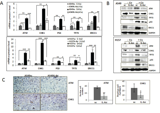 IL-6 expressing A549sc and H157sc cells showed higher expression of DNA repair molecules upon cisplatin treatment compared to A549IL-6si and H157IL-6si cells.