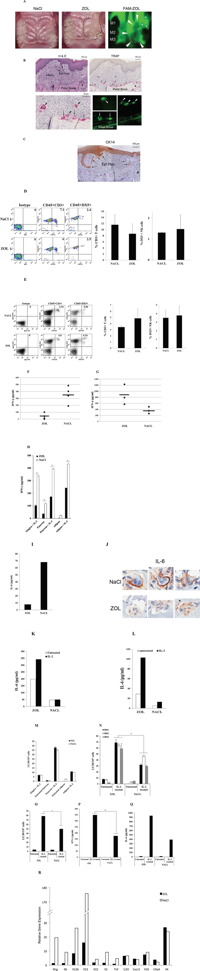 In vivo injection of ZOL triggered significant IFN-&#x03B3; and IL-6 secretion by bone marrow-derived cells but inhibited secretion by gingival cells.