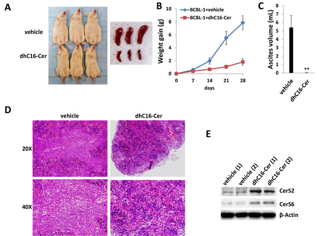Exogenous dhC16-Cer suppresses PEL tumor progression