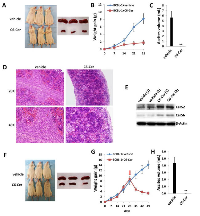 C6-Cer suppresses PEL formation and induces regression of established PEL tumors