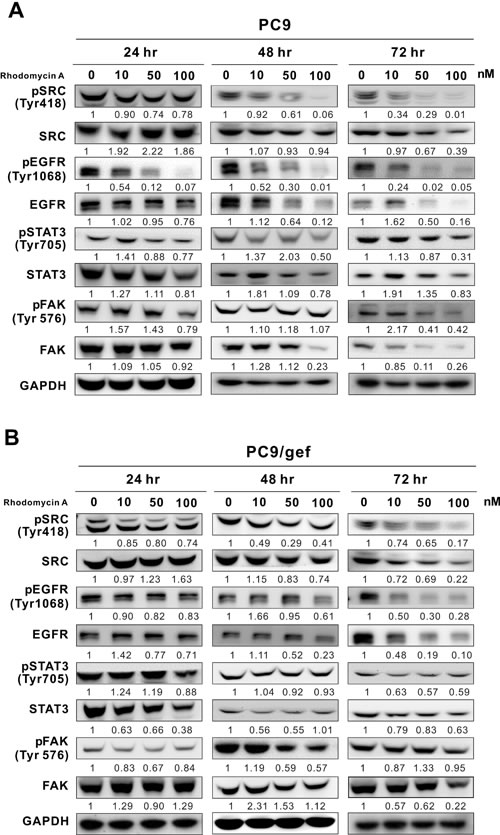 Effects of rhodomycin A on Src and its associated proteins.