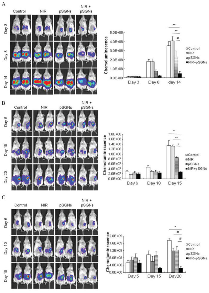 Intraperitoneal photothermal therapy induced by pSGNs with NIR laser irradiation.