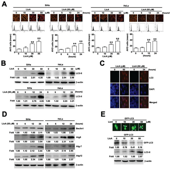 The ability of LicA to induce autophagy in SiHa and HeLa cervical cancer cells.