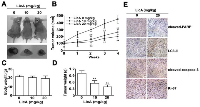 LicA inhibited the tumor progression of cervical cancer in vivo.