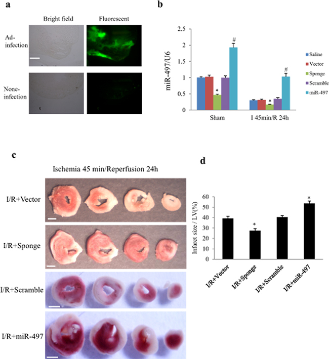 MiR-497 exerted influence on myocardial infarct size in response to myocardial ischemia/reperfusion (I/R).