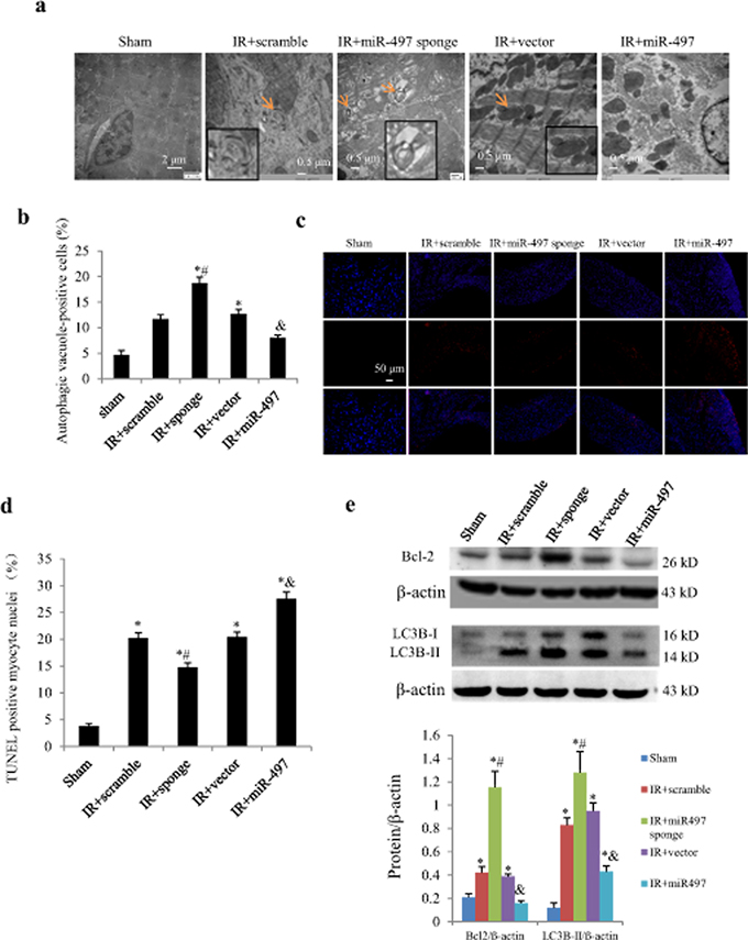 Effects of Ad-miR-497 sponge and Ad-miR-497 on myocardial autophagy and apoptosis in mice subjected to ischemia/reperfusion (IR).