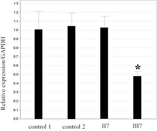 Verification of the deletion in II7 and III7 by real-time PCR.