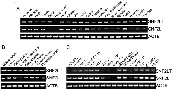 SNF2L and SNF2LT expression by RT-PCR in different normal human tissues, cancers and cell lines.