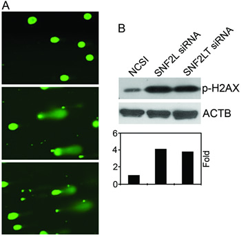 Singular v dual knockdown of SNF2L and SNF2LT and DNA damage.