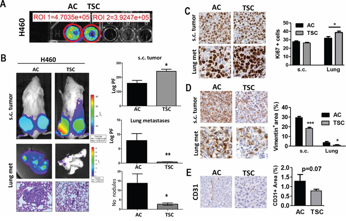 TSC cells display higher tumorogenic potential and decreased metastatic activity.