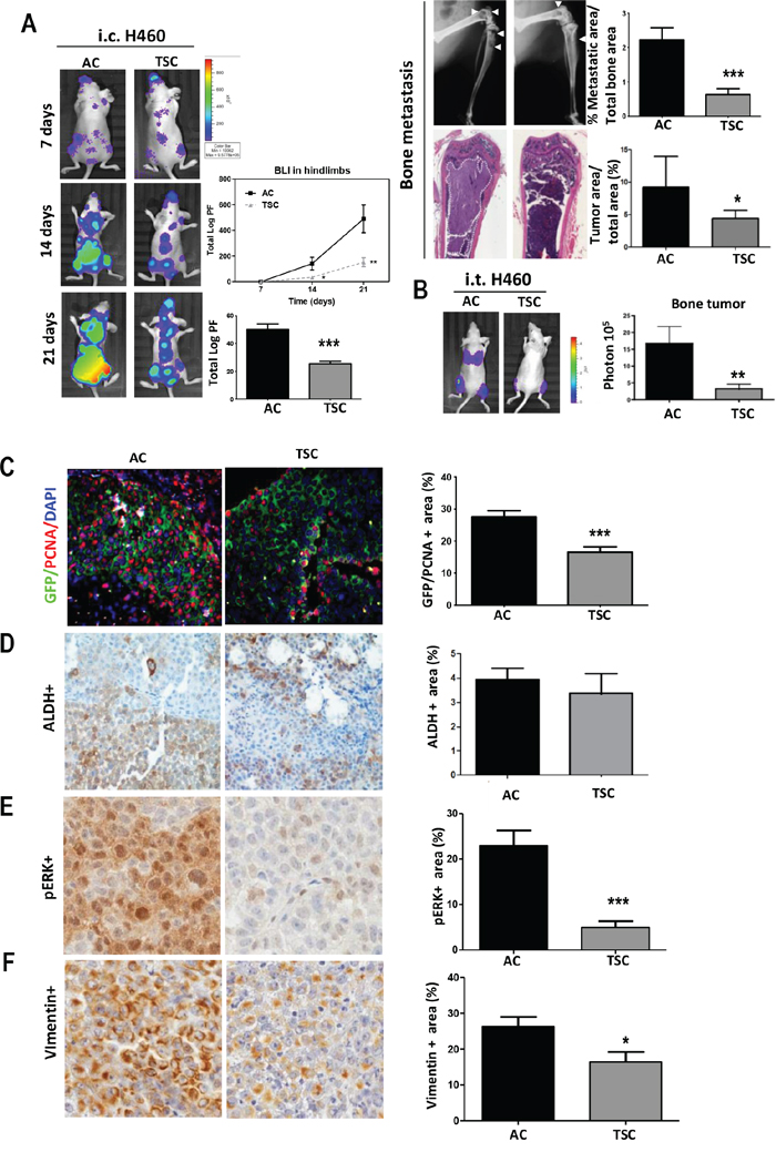 Decreased prometastatic activity of cells derived from TSC conditions.