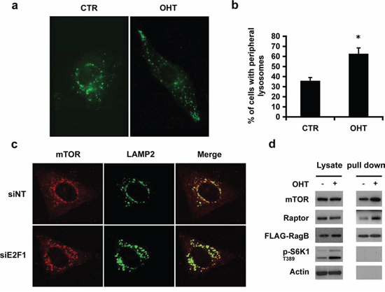 E2F1 induces lysosomal trafficking.