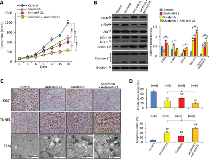 Inhibition of miR-21 enhances the efficacy of sorafenib to suppress sorafenib-resistant tumors in vivo.