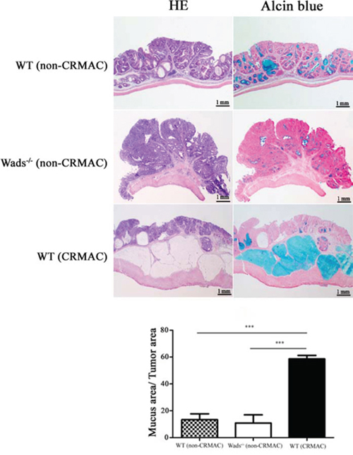 At week 37, adenocarcinomas developed CRMAC in half of WT mice, identified by HE and Alcian blue staining to assess the percentage of the mucus area (&#x2265;50% of the total tumor area).