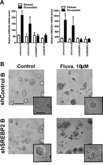 Knockdown of SREBP2 abrogates the sterol-feedback loop and impairs 3D growth of MCF7 cells upon fluvastatin treatment.