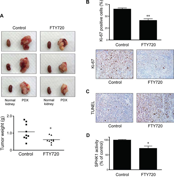 Effects of FTY720 on in vivo tumor weight, cell proliferation, apoptosis, and enzymatic activity of SPHK1 in cervical cancer PDX models.