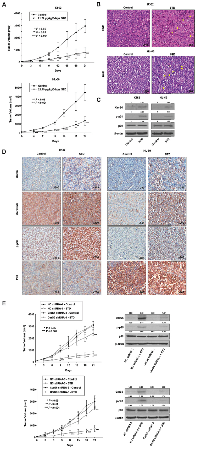 STD inhibits tumor growth of K562 and HL-60 xenografts and induces apoptosis through CerS6 activation, ceramide production, and p38 kinase activation in vivo.
