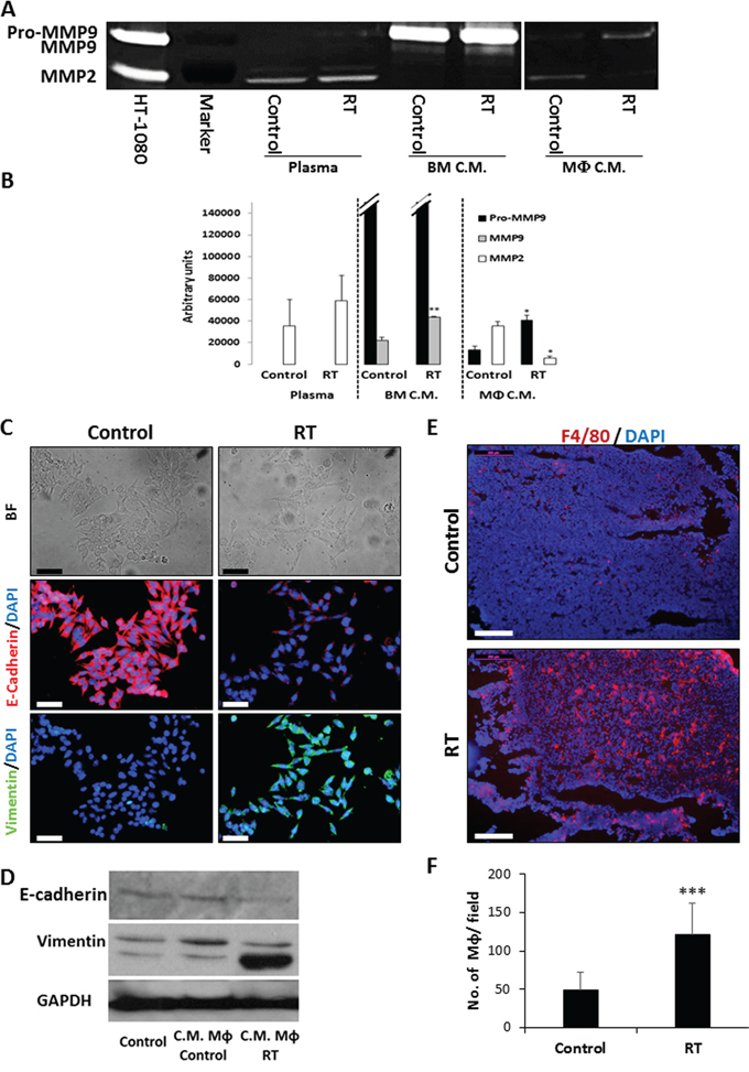 Conditioned medium of macrophages collected from locally irradiated mice promotes metastasis.