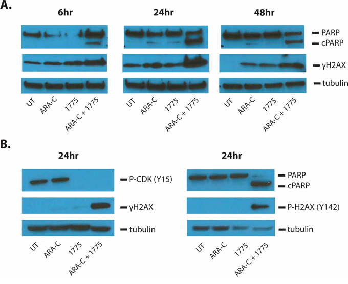 AZD1775 enhances DNA damage and apoptosis induced by cytarabine.