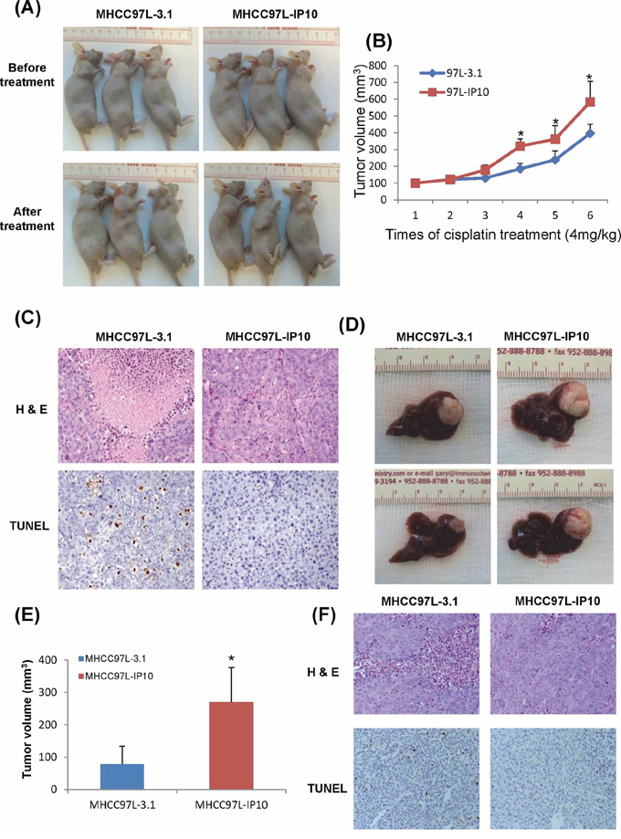 The effect of IP10 on tumor growth and chemoresistance in Subcutaneous and Orthotopic nude mice models.