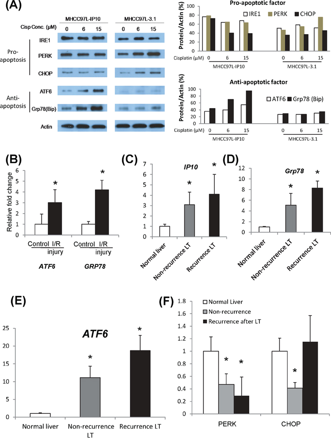 Activation of ER stress signaling pathways.