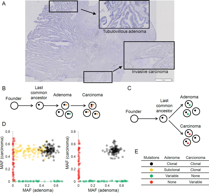 The evolutionary relationships of synchronous adenoma-carcinoma lesions inferred from the clonal architecture of somatic mutations.