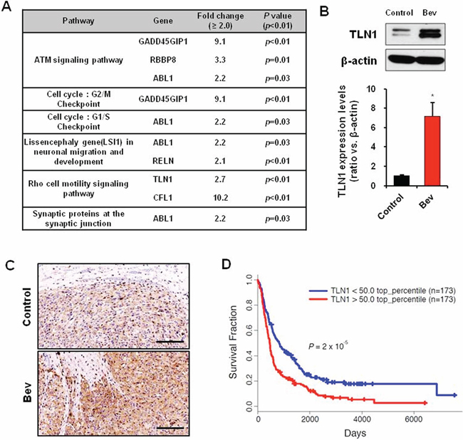 TLN1 expression was increased by bevacizumab treatment in GBM.