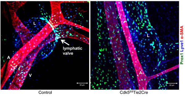 Defective lymphatic valve formation in endothelial-specific Cdk5 knockout mice.