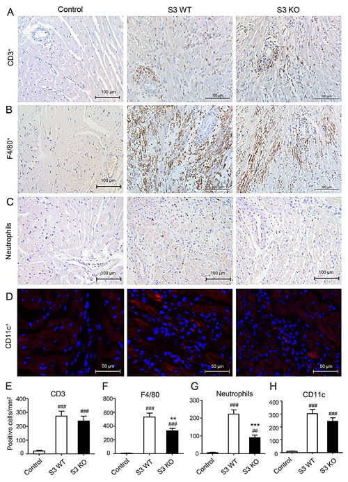 Deletion of Smad3 inhibits infiltration of inflammatory cells in cardiac allograft rejection.