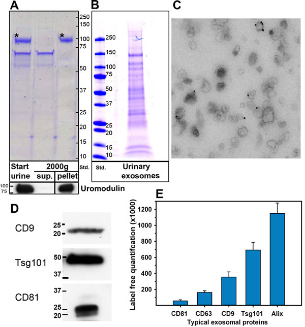 Characterization of urinary exosomes.