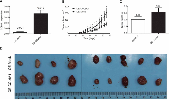 COL6A1 promotes 7860 tumor growth in nude mice.