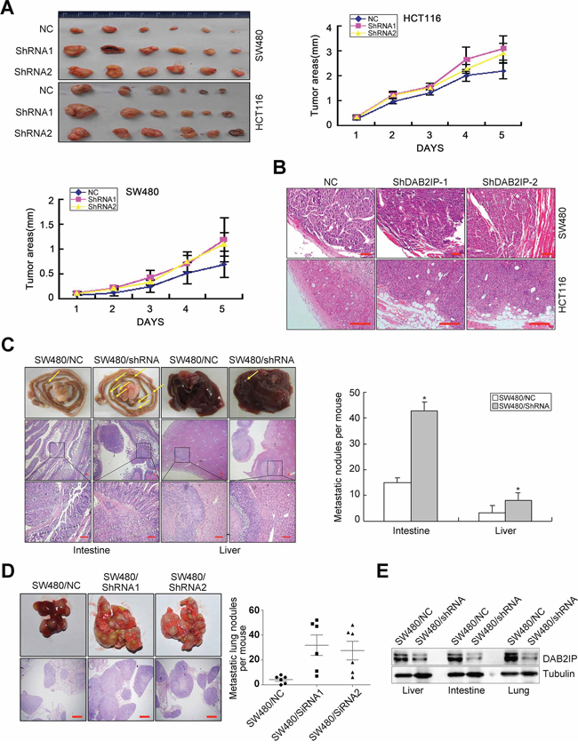 DAB2IP is sufficient to inhibit tumor growth and metastasis of CRC cells.