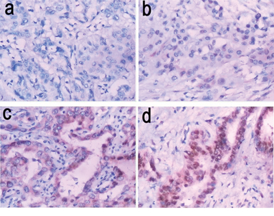 Representative images of SALL4 immunostaining (200&#x00D7; magnification).