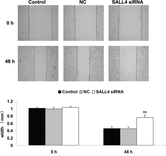Wound healing assay was conducted to determine the cell migratory capacity of ICC-9810 cells transfected with SALL4 siRNA or non-specific siRNA as negative control (NC). Non-transfected ICC-9810 cells were used as Control. **P &#x003C; 0.01 vs. Control.