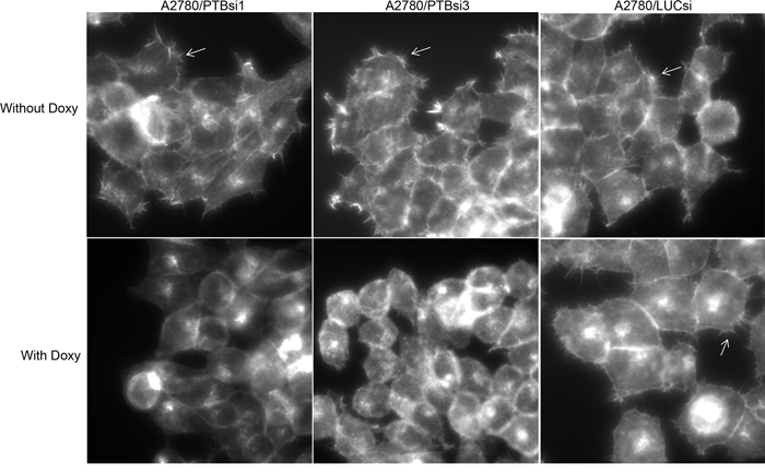 Knockdown of PTBP1 inhibits filopodia formation.