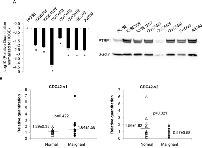 CDC42-v2 is downregulated in ovarian cancer cell lines and ovarian tumor tissues.