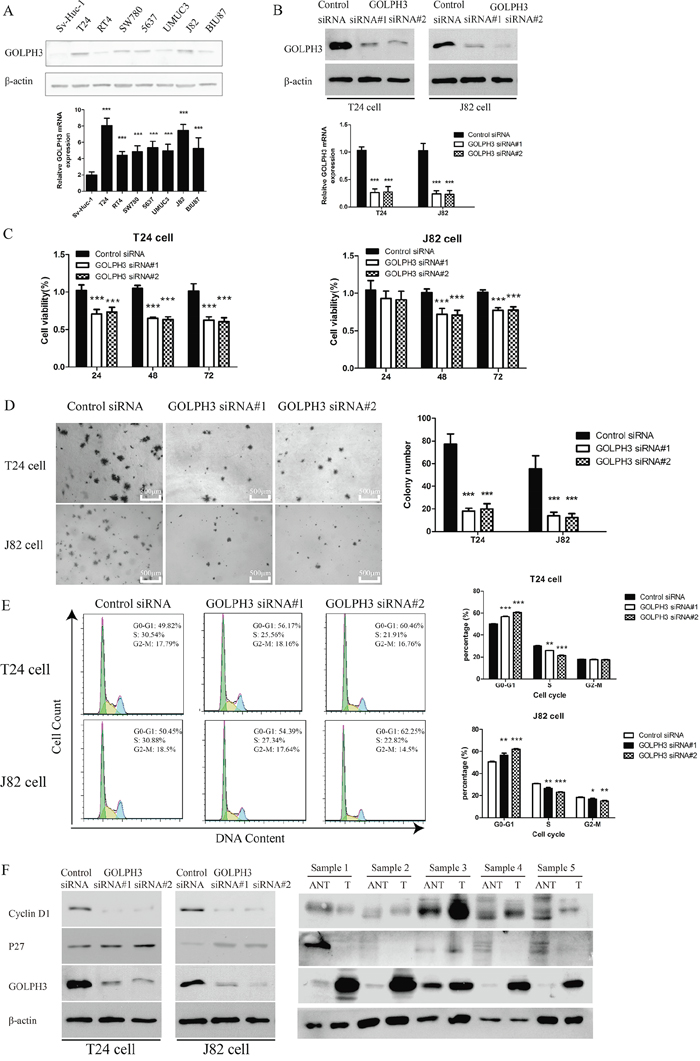 GOLPH3 silencing inhibited the proliferation and tumorigenicity of bladder cancer cells in vitro.