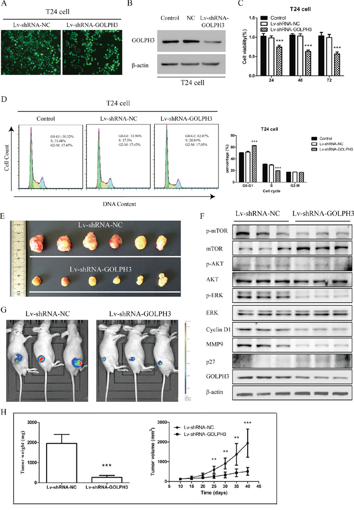 GOLPH3 silencing inhibits the tumorigenicity of bladder cancer cells in vitro and in vivo.
