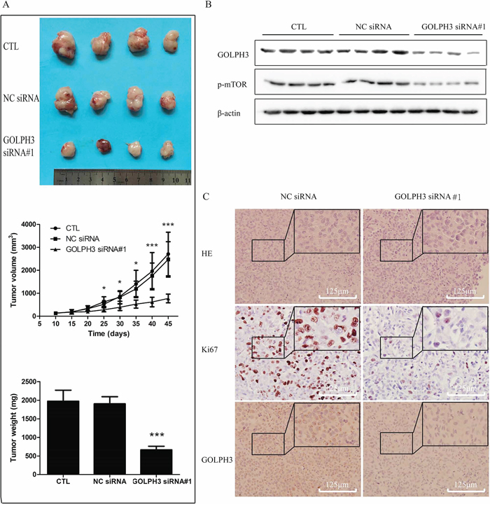 GOLPH3 may as a promising therapeutic target for bladder cancer in vivo.