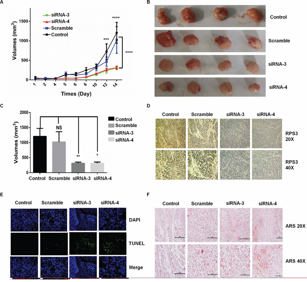 Knockdown of RPS3 inhibited tumor growth on melanoma in vivo.