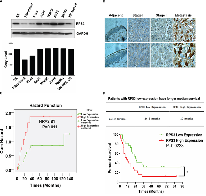 RPS3 was highly expressed in melanoma cell lines and tumor tissues and associated with poor prognosis.