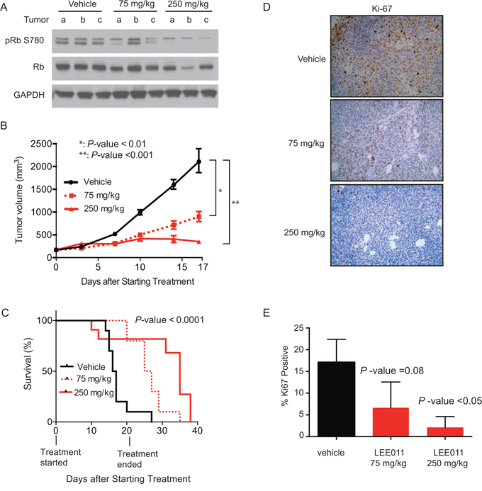 LEE011 impairs Ewing sarcoma tumor xenograft growth in vivo.