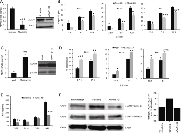 ADAR1 regulates melanoma immune resistance.