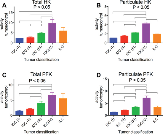 HK and PFK activities of the tumor samples separated with regard to tumor classification.