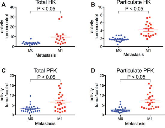 HK and PFK activities of the tumor samples separated with regard to the occurrence of metastasis.