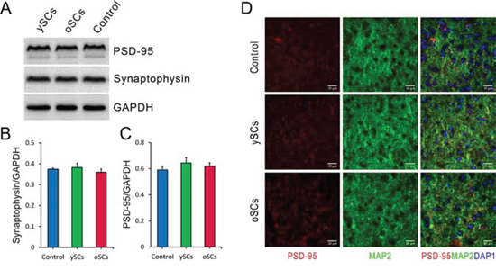 The effect of SCs treatments on cerebral synaptic plasticity of old APPswe/PSENldE9 transgenic mice.